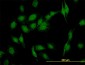 SEC22L1 Antibody (monoclonal) (M01)